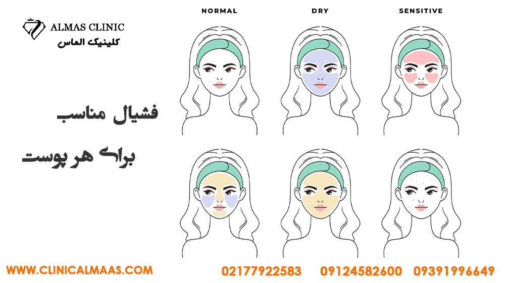 فشیال مناسب هر نوع پوست در بهترین کلینیک فیشیال شرق تهران